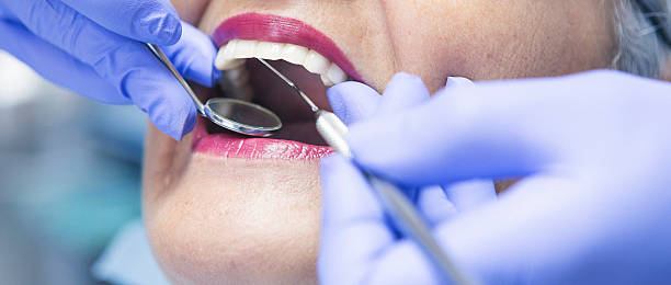 Best Chipped Tooth Repair Near Me  in Davenport, FL